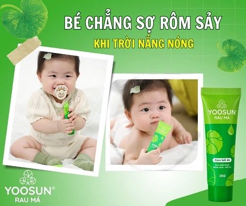 Cách trị rôm sảy ở mặt cho trẻ sơ sinh