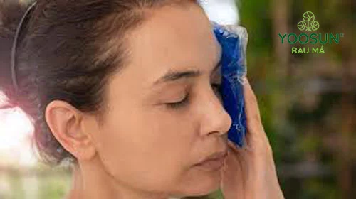 cách trị dị ứng kem body