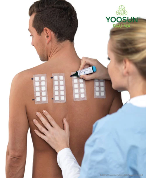 dấu hiệu dị ứng mỹ phẩm body