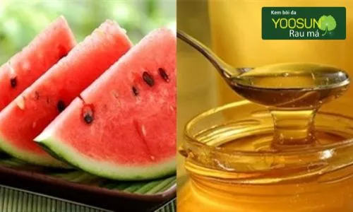 dưa hấu trị mụn