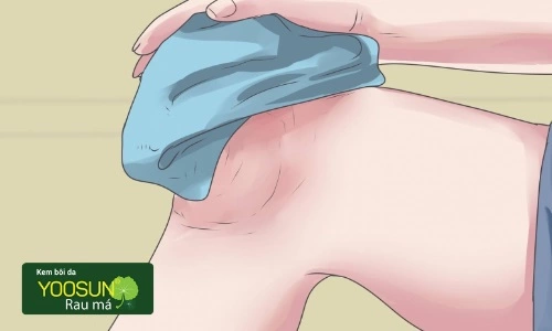 Điều trị viêm nang lông ở chân tại nhà