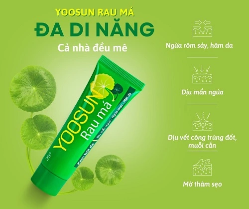 Bị nổi mày đay có được nằm quạt không