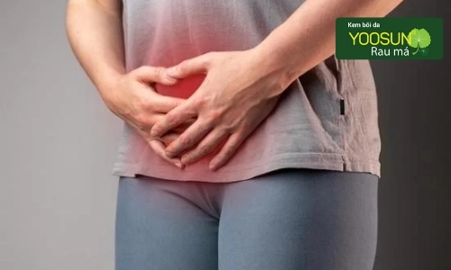 Nổi mẩn đỏ ngứa ở háng nữ giới và nam giới. Cảnh giác!