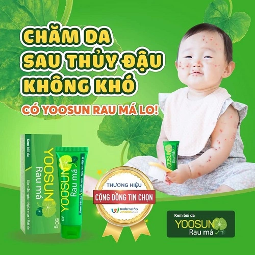 thuốc bôi giảm ngứa thủy đậu