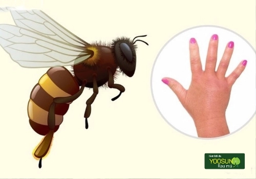 Bị ong tò vò đốt có độc không