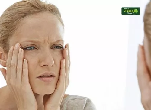 Bật mí cách trị da khô nhăn nheo trở nên mịn màng hơn