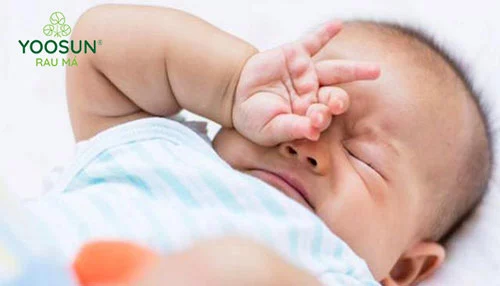 cách trị chàm sữa ở trẻ em