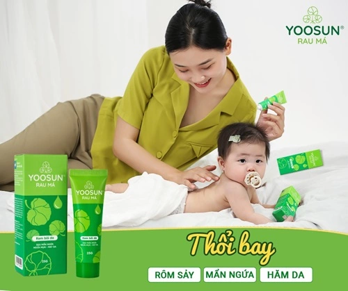 Cách trị rôm sảy bằng hồ nước cần lưu ý gì Cách trị rôm sảy bằng hồ nước