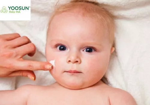 Liệu dùng hồ nước có chữa rốm sảy không Hồ nước có chữa rốm sảy không