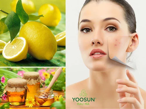 Bị nổi sảy có để lại sẹo không