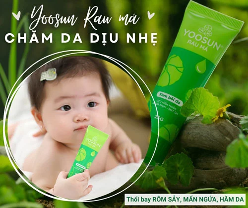 Nổi rôm sảy có để lại sẹo không